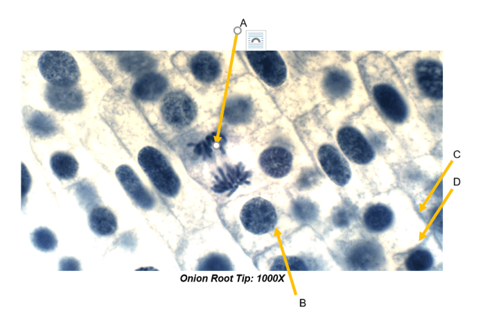 Onion root tip 1000x labeled