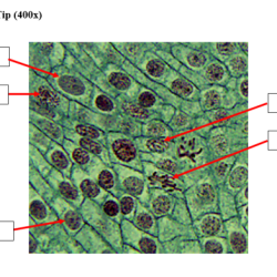 Onion root tip 1000x labeled