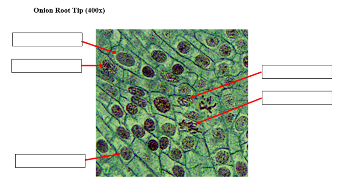 Onion root tip 1000x labeled